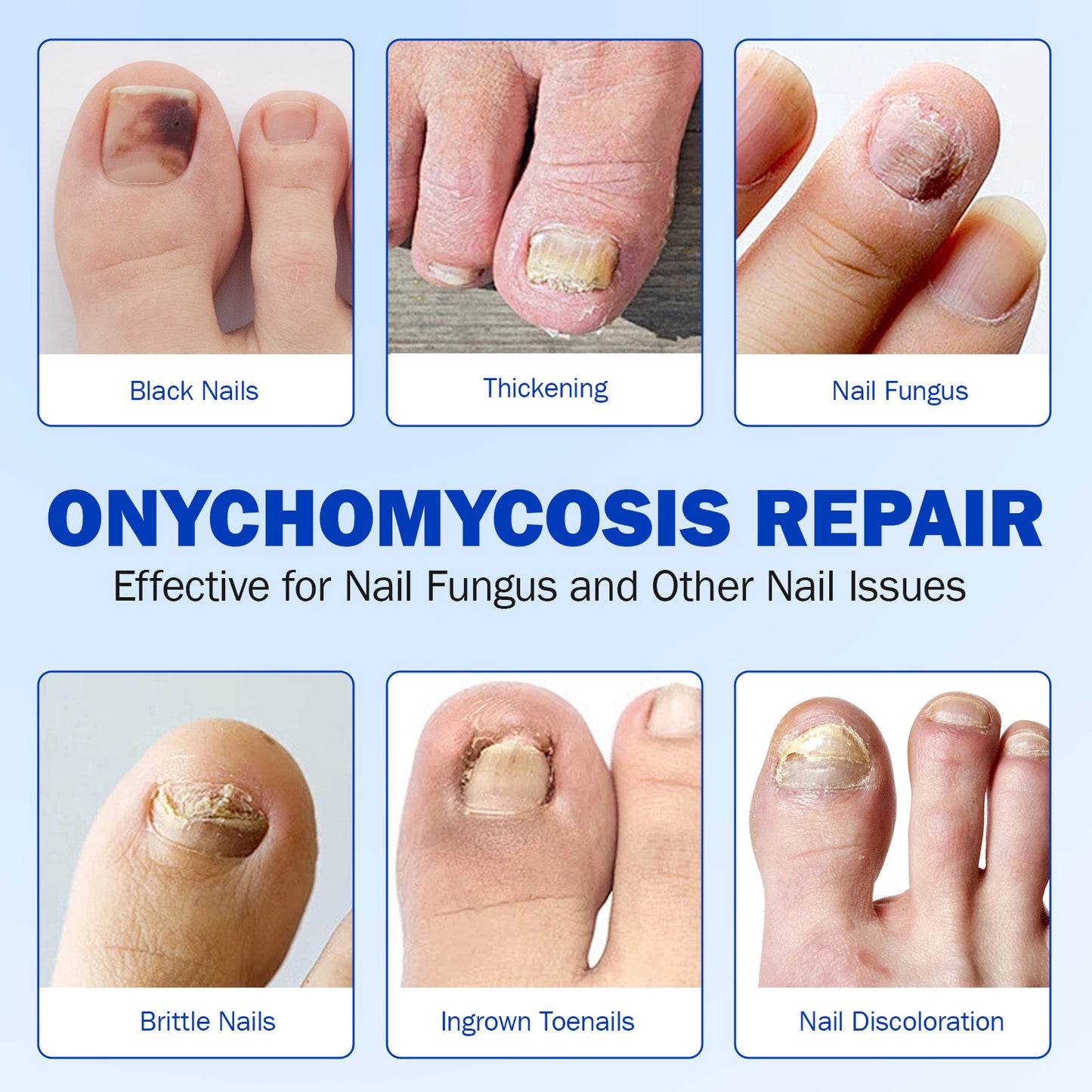 PureNail Fungal Patches