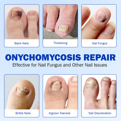 PureNail Fungal Patches